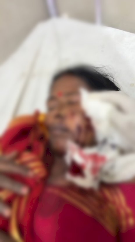 बाग मालिक व बाग रखवार के पुत्र के बीच हुआ विवाद मारपीट में हुआ तब्दील, दोनों गंभीर
