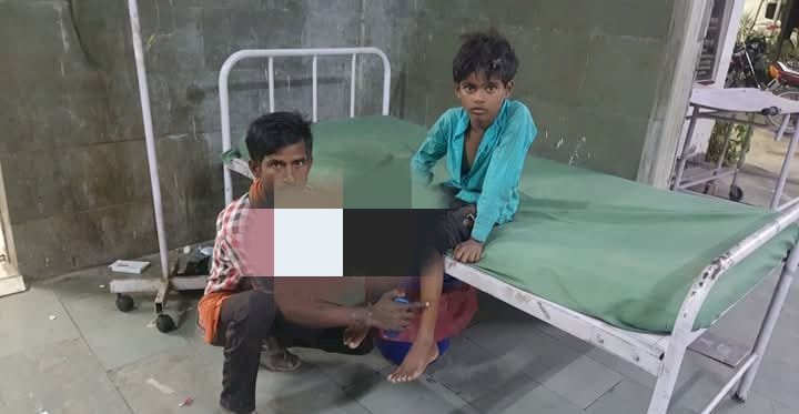 रायबरेली-नेवले का शिकार हुआ 8 वर्षीय बच्चा, किया गया इलाज