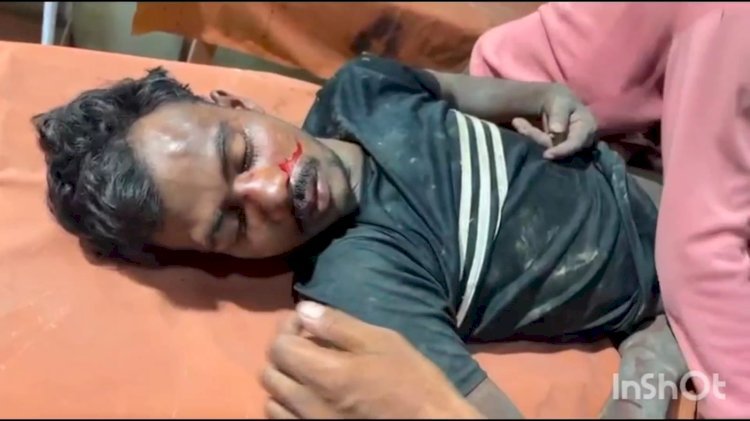 रायबरेली-दो भाइयों के बीच हुई मारपीट, एक भाई जिला अस्पताल रेफर