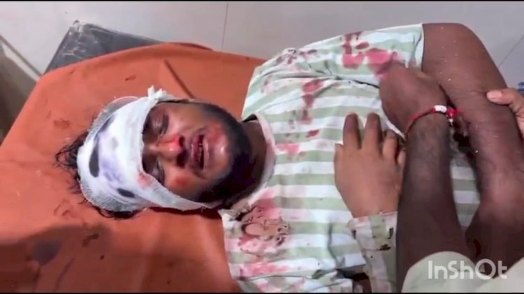 रायबरेली-तेज रफ्तार बाइक सड़क मार्ग पर फिसलकर हुई अनियंत्रित, दो भाई घायल