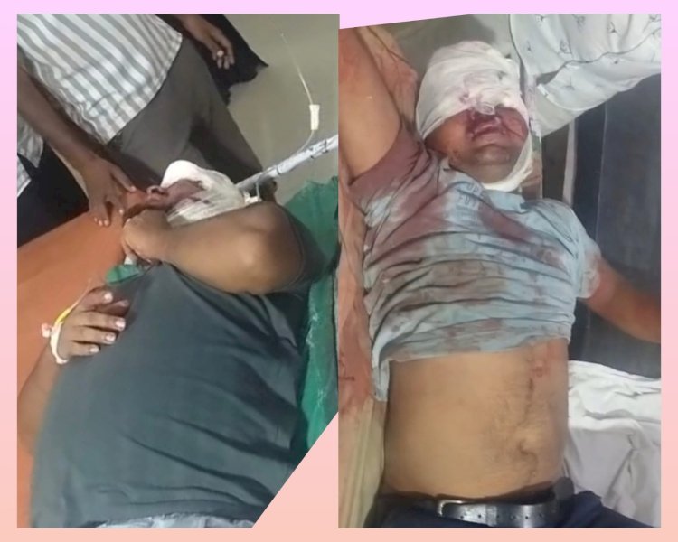 दो मोटरसाइकिलों की टक्कर में दो युवक गंभीर, लखनऊ ट्रामा सेंटर रेफर