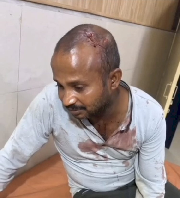 रायबरेली आपसी विवाद में युवक पर जानलेवा हमला, गंभीर घायल