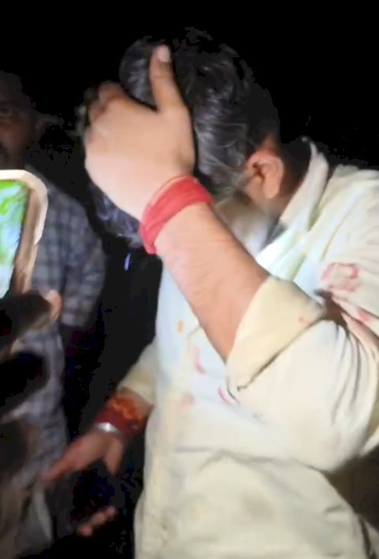 रायबरेली-मामूली कहासुनी के बाद खूनी खेल! घात लगाकर बैठे दबंगों ने युवकों को पीटा